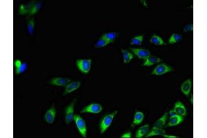 Immunofluorescent analysis of Hela cells using ABIN7160866 at dilution of 1:100 and Alexa Fluor 488-congugated AffiniPure Goat Anti-Rabbit IgG(H+L) (SIRT7 antibody  (AA 242-379))