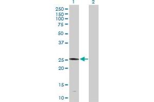 Western Blot analysis of PLA2G4D expression in transfected 293T cell line by PLA2G4D MaxPab polyclonal antibody. (PLA2G4D antibody  (AA 1-216))