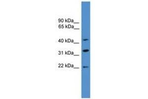Image no. 1 for anti-ADP-Ribosylation Factor Interacting Protein 1 (ARFIP1) (C-Term) antibody (ABIN6746382) (ARFIP1 antibody  (C-Term))