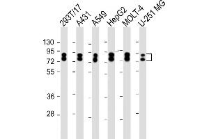 All lanes : Anti-HNRNPR Antibody (N-term) at 1:2000 dilution Lane 1: 293T/17 whole cell lysate Lane 2: A431 whole cell lysate Lane 3: A549 whole cell lysate Lane 4: HepG2 whole cell lysate Lane 5: MOLT-4 whole cell lysate Lane 6: U-251 MG whole cell lysate Lysates/proteins at 20 μg per lane.