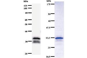Left: DDB2 staining. (DDB2 antibody)