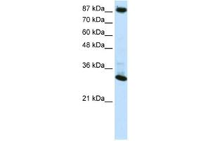 WB Suggested Anti-CTCF Antibody Titration:  0. (CTCF antibody  (N-Term))