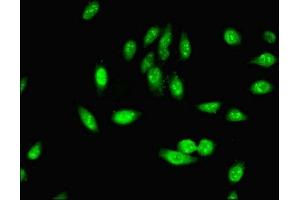 Immunofluorescent analysis of Hela cells using ABIN7163064 at dilution of 1:100 and Alexa Fluor 488-congugated AffiniPure Goat Anti-Rabbit IgG(H+L) (PHF5A antibody  (AA 1-110))