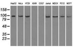 Image no. 2 for anti-Neurotrophic tyrosine Kinase, Receptor, Type 3 (NTRK3) antibody (ABIN1499843) (NTRK3 antibody)