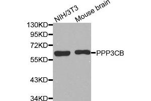 Western Blotting (WB) image for anti-Protein Phosphatase 3, Catalytic Subunit, beta Isozyme (PPP3CB) antibody (ABIN1874234) (PPP3CB antibody)