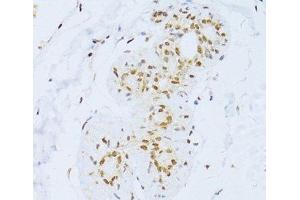 Immunohistochemistry of paraffin-embedded Human breast using ZEB2 Polyclonal Antibody at dilution of 1:100 (40x lens). (ZEB2 antibody)