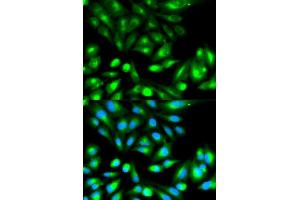 Immunofluorescence analysis of HeLa cell using RHOC antibody. (RHOC antibody  (AA 1-193))