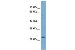 Host:  Rabbit  Target Name:  SLC13A3  Sample Type:  COLO205 Whole cell lysates  Antibody Dilution:  1.