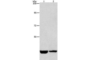 Western Blot analysis of Hela and A431 cell using CSNK1E Polyclonal Antibody at dilution of 1:1550 (CK1 epsilon antibody)