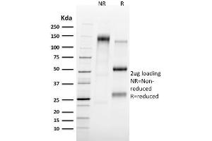 SDS-PAGE Analysis Purified Tal1 Mouse Monoclonal Antibody (TAL1/2707). (TAL1 antibody)