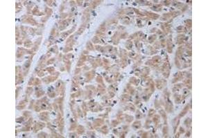 Immunohistochemical staining of formalin-fixed paraffin-embedded human heart showing staining with ADRA1B polyclonal antibody  at 1:100 dilution.