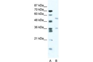Western Blotting (WB) image for anti-BTB (POZ) Domain Containing 3 (BTBD3) antibody (ABIN2461041) (BTBD3 antibody)