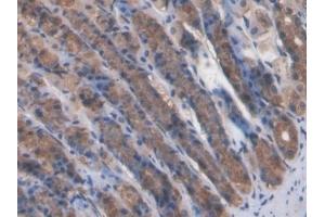 Immunohistochemistry (IHC) image for anti-Tumor Necrosis Factor alpha (TNF alpha) (AA 80-235) antibody (ABIN7427300)