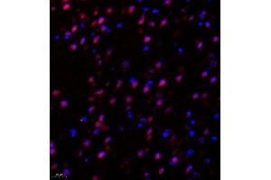 Immunofluorescence of paraffin embedded mouse hippocampus using Suv39h2 (ABIN7075771) at dilution of 1:2000 (400x lens) (SUV39H2 antibody)
