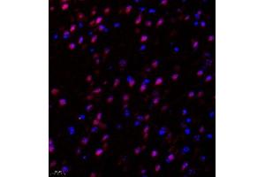 Immunofluorescence of paraffin embedded mouse hippocampus using Suv39h2 (ABIN7075771) at dilution of 1:2000 (400x lens)