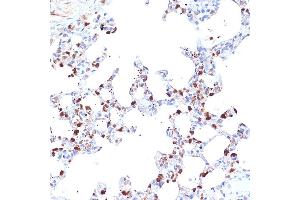 Immunohistochemistry (IHC) image for anti-Endoplasmic Reticulum Aminopeptidase 1 (ERAP1) antibody (ABIN7266941)