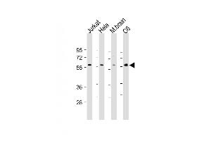 All lanes : Anti-AKT2 Antibody at 1:500-1:2000 dilution Lane 1: Jurkat whole cell lysate Lane 2: Hela whole cell lysate Lane 3: Mouse brain lysate Lane 4: C6 whole cell lysate Lysates/proteins at 20 μg per lane. (AKT2 antibody)