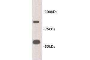 Western Blotting (WB) image for anti-Transmembrane Protein 2 (TMEM2) antibody (ABIN1854991) (TMEM2 antibody)