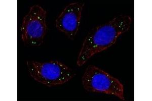 Fluorescent image of U251 cell stained with MERTK antibody at 1:25. (MERTK antibody)