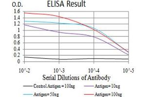 Fig. (SOD2 antibody  (AA 1-222))