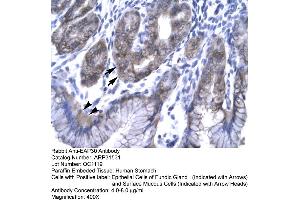Rabbit Anti-EAP30 Antibody  Paraffin Embedded Tissue: Human Stomach Cellular Data: Epithelial cells of Fundic Gland and Surface Mucous Cells Antibody Concentration: 4. (SNF8 antibody  (N-Term))