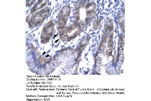Rabbit Anti-EAP30 Antibody  Paraffin Embedded Tissue: Human Stomach Cellular Data: Epithelial cells of Fundic Gland and Surface Mucous Cells Antibody Concentration: 4. (SNF8 antibody  (N-Term))