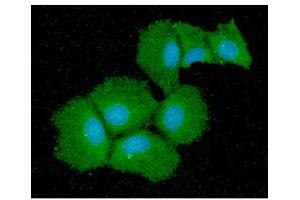 ICC/IF analysis of QPRT in Hep3B cells line, stained with DAPI (Blue) for nucleus staining and monoclonal anti-human QPRT antibody (1:100) with goat anti-mouse IgG-Alexa fluor 488 conjugate (Green). (QPRT antibody  (AA 1-297))
