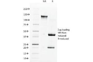 SDS-PAGE Analysis Purified ACE / CD143 Mouse Monoclonal Antibody (9B9). (Angiotensin I Converting Enzyme 1 antibody)