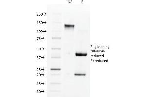 SDS-PAGE Analysis Purified ACE / CD143 Mouse Monoclonal Antibody (9B9).