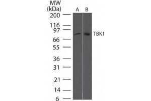 Western Blotting (WB) image for anti-TANK-Binding Kinase 1 (TBK1) antibody (ABIN6655825)