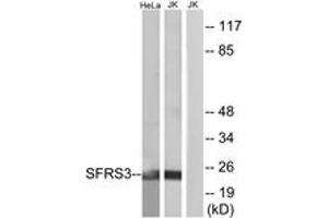 Western blot analysis of extracts from HeLa/Jurkat cells, using SFRS3 Antibody. (SRSF3 antibody  (AA 111-160))