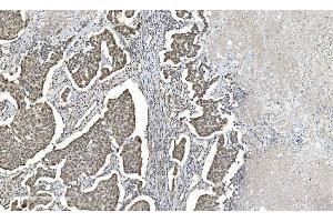 IHC analysis of HDAC5 using anti-HDAC5 antibody (ABIN7599922). (HDAC5 antibody  (AA 13-1107))