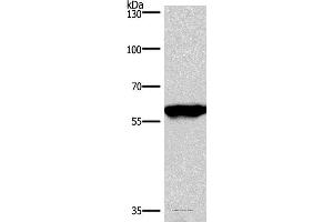 Western blot analysis of Mouse brain tissue, using PPP3CA Polyclonal Antibody at dilution of 1:900 (PPP3CA antibody)
