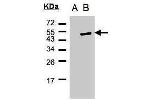 WB Image Western Blot analysis of PSCD1 expression in transfected 293T cell line by PSCD1 polyclonal antibody. (Cytohesin 1 antibody)