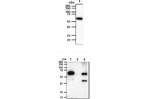The cell lysates (40ug) were resolved by SDS-PAGE, transferred to PVDF membrane and probed with anti-human AKT1/3 antibody (1:1000). (AKT1/3 antibody)