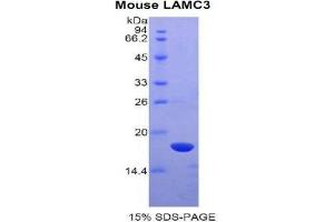 SDS-PAGE (SDS) image for Laminin, gamma 3 (LAMC3) (AA 751-875) protein (His tag) (ABIN2121532)