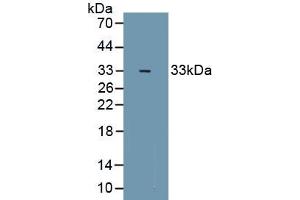 Detection of Recombinant ZFHX1B, Mouse using Polyclonal Antibody to Zinc Finger Homeobox Protein 1B (ZFHX1B) (ZEB2 antibody  (AA 962-1215))