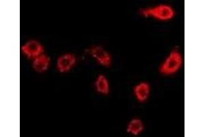 Immunofluorescent analysis of Moesin staining in Hela cells. (Moesin antibody)