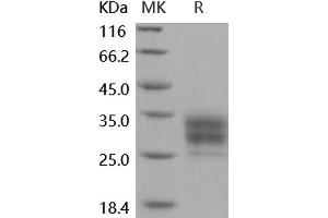 Western Blotting (WB) image for Low Affinity Immunoglobulin gamma Fc Region Receptor IV (FCGR4) (Active) protein (His tag) (ABIN7196847) (Low Affinity Immunoglobulin gamma Fc Region Receptor IV (FCGR4) (Active) protein (His tag))