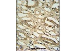 GGTLC2 antibody (Center) (ABIN654174 and ABIN2844032) immunohistochemistry analysis in formalin fixed and paraffin embedded human lung tissue followed by peroxidase conjugation of the secondary antibody and DAB staining. (GGTLC2 antibody  (AA 127-154))