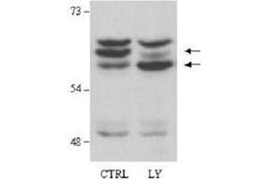 Immunoblotting of AKT2 polyclonal antibody  detects both unphosphorylated and phosphorylated AKT2. (AKT2 antibody  (AA 455-468))