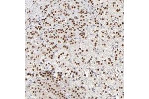 Immunohistochemical staining (Formalin-fixed paraffin-embedded sections) of human adrenal gland shows strong nuclear positivity in cortical cells. (PBX1 antibody)