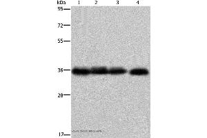 Western blot analysis of K562 cell and  human kidney cancer tissue, 293T and HepG2 cell, using F11R Polyclonal Antibody at dilution of 1:600 (F11R antibody)