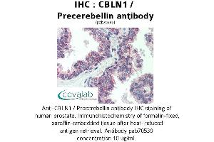 Image no. 1 for anti-Cerebellin 1 Precursor (CBLN1) antibody (ABIN1732717)
