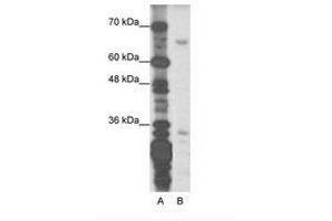 Image no. 1 for anti-Zinc Finger Protein 691 (ZNF691) (N-Term) antibody (ABIN202159) (ZNF691 antibody  (N-Term))