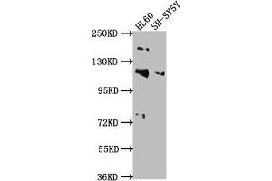 Western Blot Positive WB detected in: HL60 whole cell lysate, SH-SY5Y whole cell lysate All lanes: RAPGEF1 antibody at 1:2000 Secondary Goat polyclonal to rabbit IgG at 1/50000 dilution Predicted band size: 121, 117, 123 kDa Observed band size: 121 kDa (GRF2 antibody  (AA 22-40))