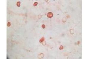 Immunohistochemistry (IHC) image for anti-KSHVK8a antibody (ABIN2464074) (KSHVK8a antibody)