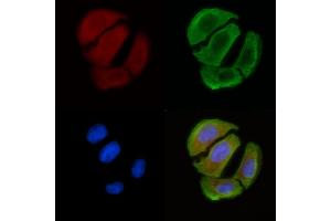 ABIN6258526 and ABIN6274768 staining Hela cells(30 min of UV treatment) by IF/ICC. (RPL12 antibody  (C-Term))