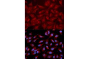 Immunofluorescence analysis of U2OS cells using RAPGEF3 antibody. (RAPGEF3 antibody  (AA 1-200))