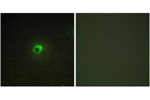 Immunofluorescence analysis of COS7 cells, using ACTR-1C Antibody. (ACVR1C/ALK7 antibody  (AA 201-250))